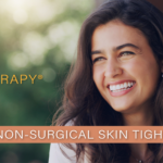 ultherapy