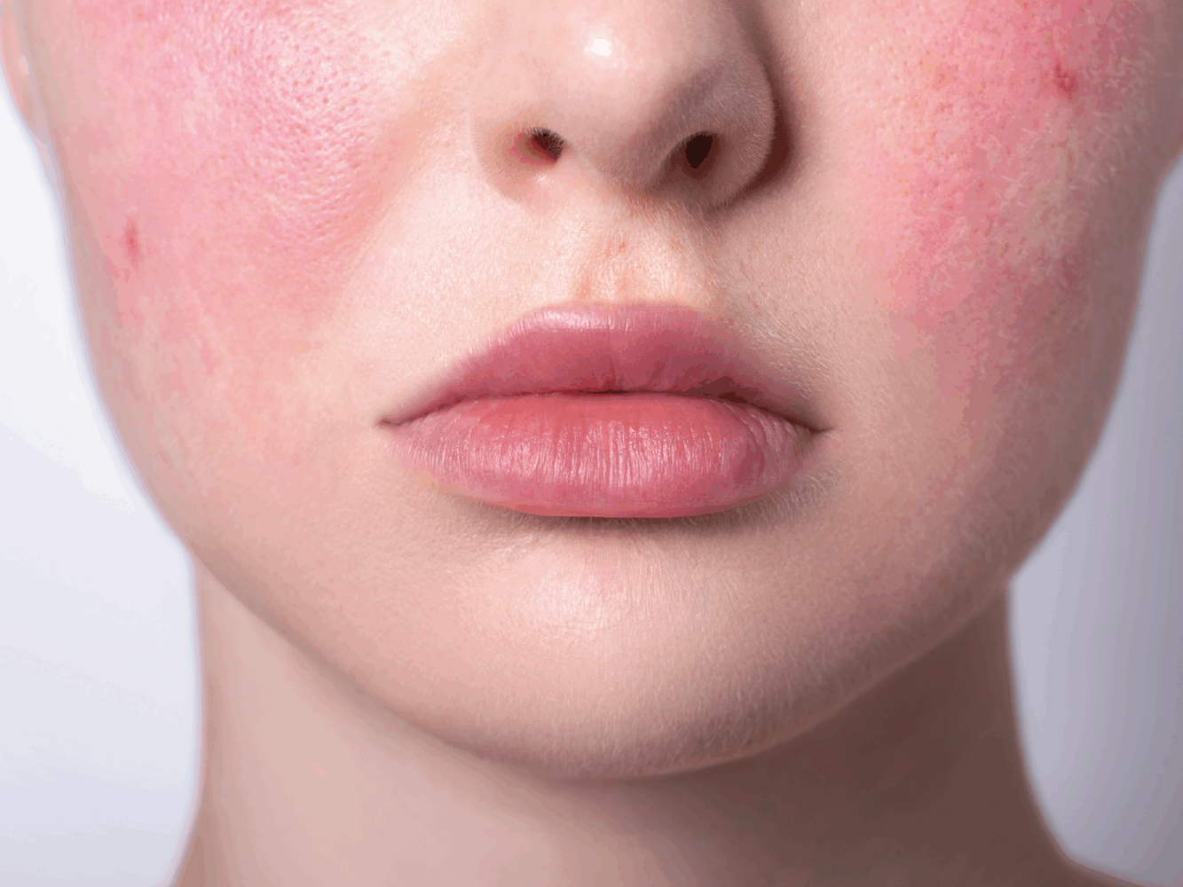 Sensitive Skin